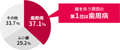 歯を失う原因の第1位は歯周病（歯周病37.1%、ムシ歯29.2%、その他33.7%）